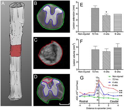 A Combination of Ex vivo Diffusion MRI and Multiphoton to Study Microglia/Monocytes Alterations after Spinal Cord Injury